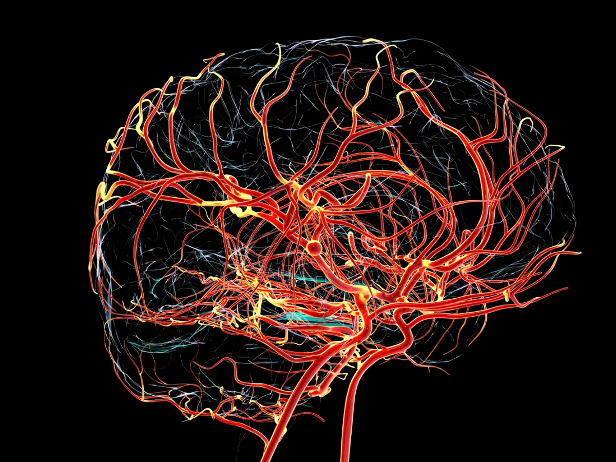 Alterações do Alzheimer podem surgir antes de falhas na memória, diz estudo
