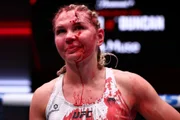 Daria Zhelezniakova ficou com corte profundo na testa após cotovelada da brasileira.
