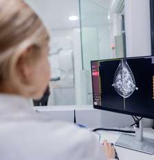 Inteligência artificial pode ajudar na detecção de câncer de mama Foto: FG Trade/