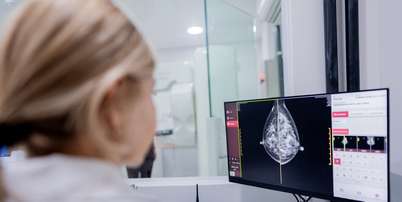 Inteligência artificial pode ajudar na detecção de câncer de mama Foto: FG Trade/